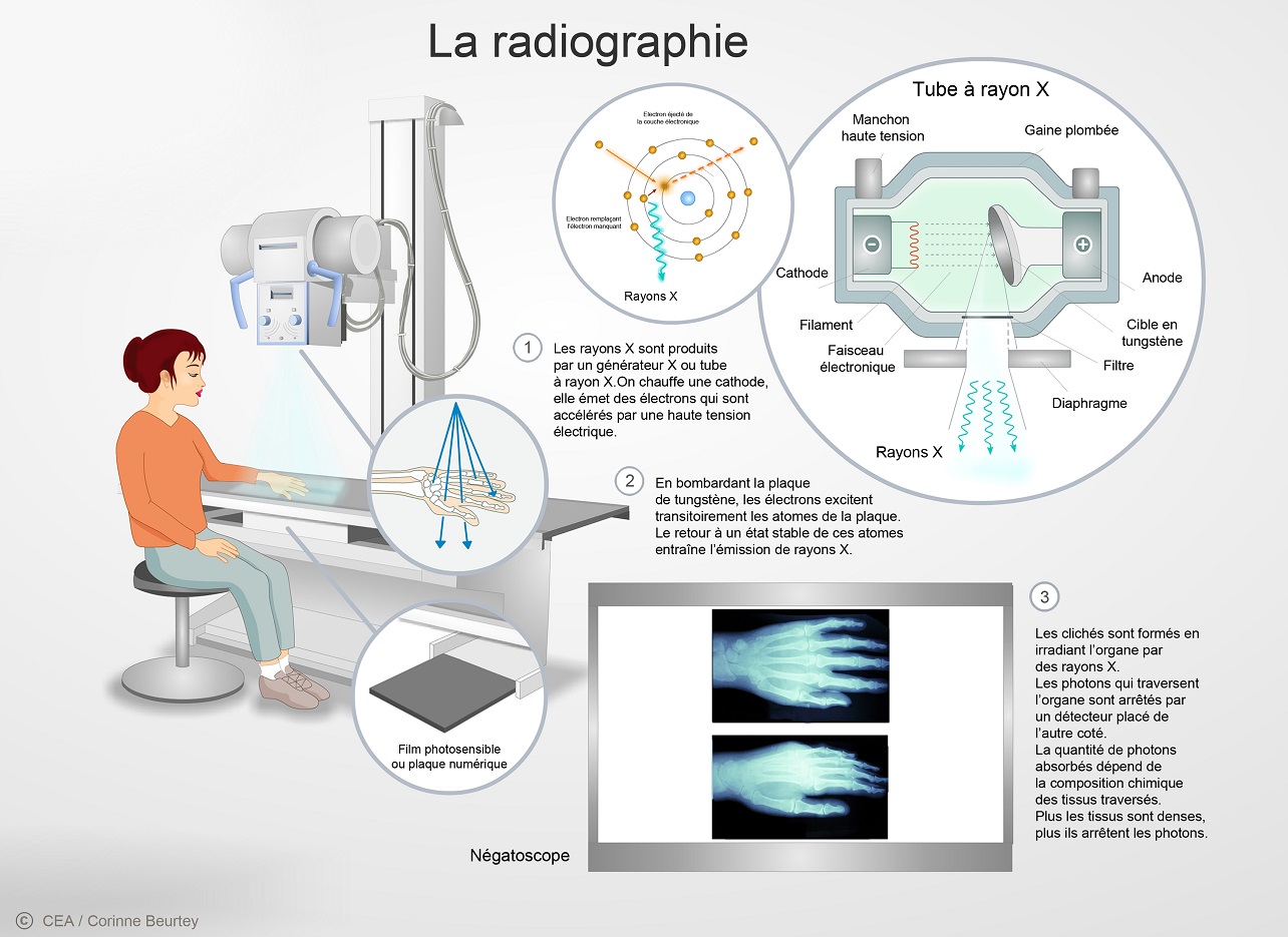Comparatif des meilleurs Scanners 3D : Prix, Avis, Caractéristiques, lequel acheter ? 9 radiograp250413